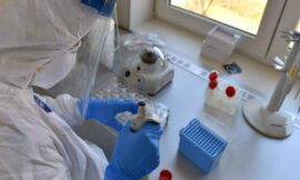 Серолошки тестови на SARS-CoV-2: шта се детектује и који антигени се користе?